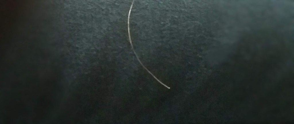 Image of a "broken" hair with a white tip like the hair