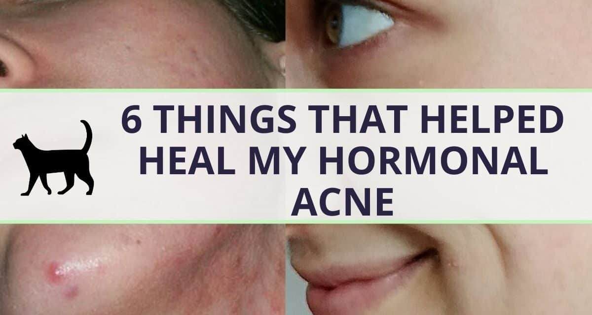 I beat hormonal acne: My 6 powerful little secrets